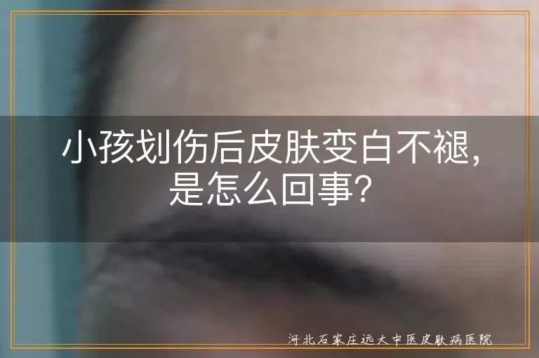 小孩划伤,皮肤变白,纤维增生,炎症后色素减退,局部血液循环不良,色素缺失,局部感染,伤口护理,防晒保护,专业治疗