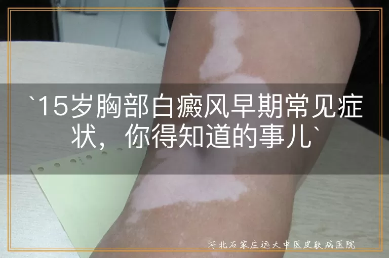 15岁,胸部白癜风,早期症状,白斑,扩散,敏感,毛发变白,早治疗
