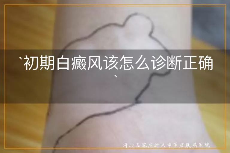 白癜风,初期诊断,白斑变化,专业设备,排除其他皮肤病,医生建议