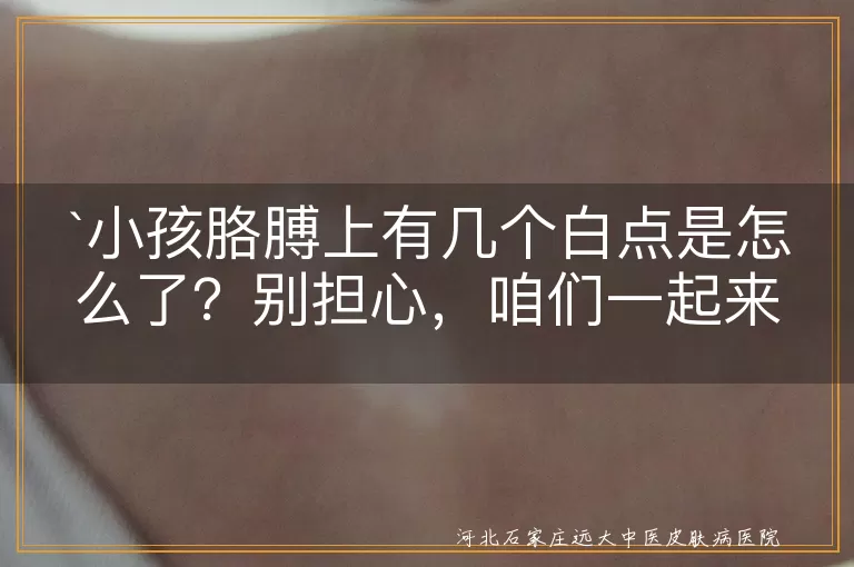 小孩胳膊白点,皮肤干燥,紫外线过敏,维生素缺乏,汗斑湿疹,色素沉着不均,皮肤护理,均衡饮食,及时就医