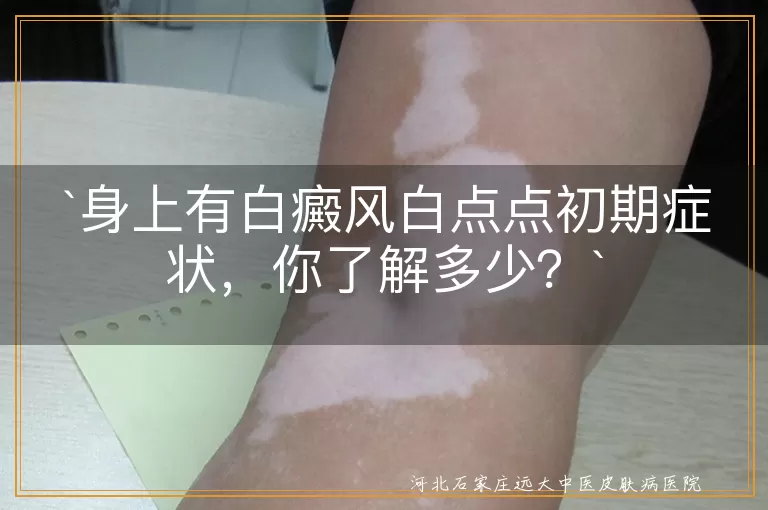 白癜风,白点点,初期症状,皮肤,暴露部位,判断方法,应对措施