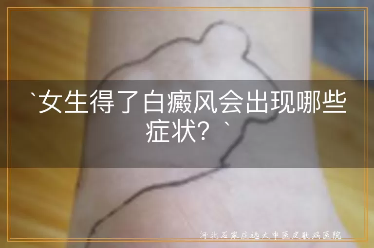 白癜风,女生,皮肤白斑,毛发变白,感觉异常,阳光敏感,虹膜颜色异常,脱屑