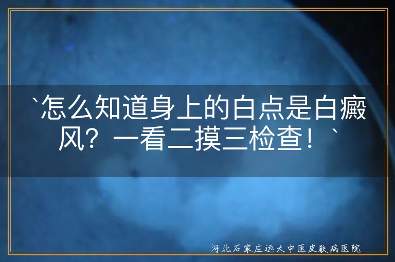 白癜风,白斑,伍德灯,皮肤CT,皮肤镜,贫血痣,无色素痣,花斑癣