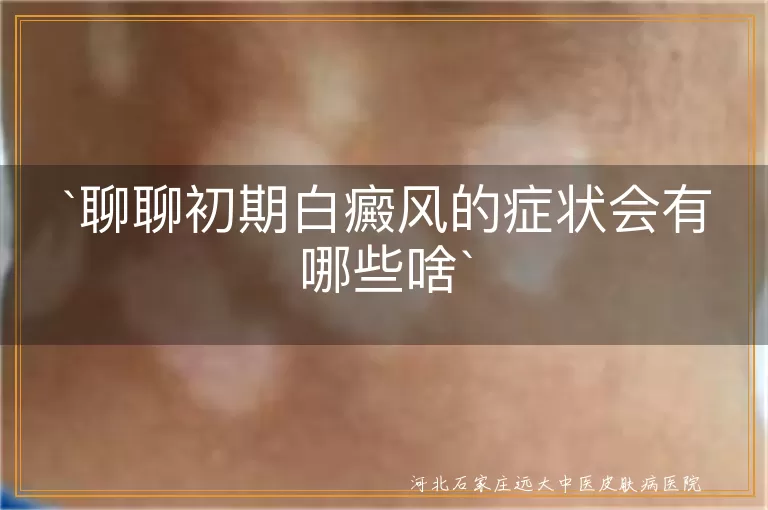 白癜风,初期症状,白斑,颜色差别,皮肤感觉,变化,其他症状