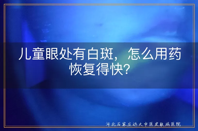 儿童眼处白斑,用药恢复,病因明确,遵医嘱,生活调理,心理关怀