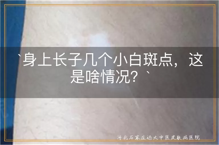 小白斑点,色素减退斑,内分泌失调,缺乏微量元素,白癜风,贫血痣,良性,就医检查