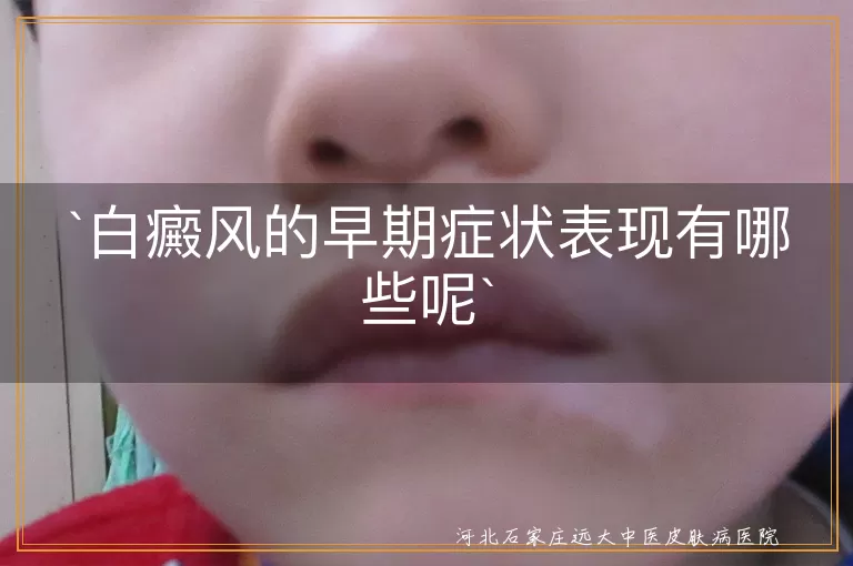 白癜风,早期症状,白斑,颜色异常,形状不规则,感觉异常,发展迅速