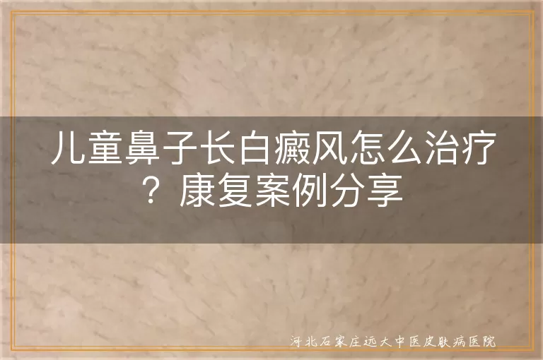 儿童白癜风,康复案例,早治疗,家庭护理,专业治疗,耐心配合