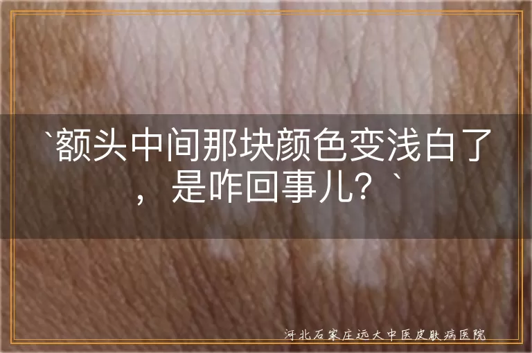 额头颜色变浅,白斑,色素沉着不均,皮肤干燥,贫血,营养不良,就医