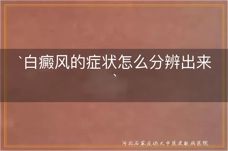 白癜风,症状,白斑,皮肤病,分辨,治疗