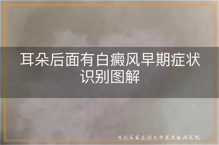白癜风,耳朵后面,早期症状,识别,预防,治疗,心态调整,防晒,保湿,均衡饮食