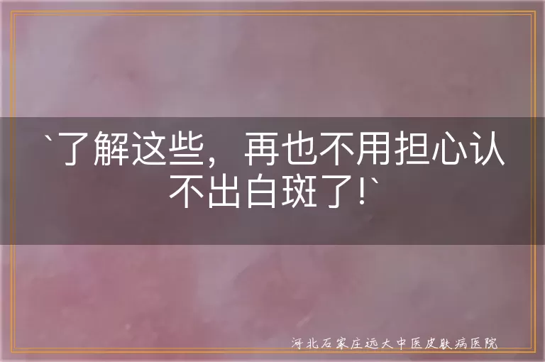 白斑,白癜风,先天性白斑,后天性白斑,治疗,预防
