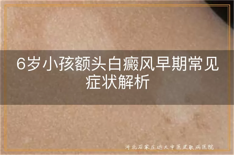 6岁小孩,额头白癜风,早期症状,白斑,头发变白,瘙痒,乏力,食欲减退