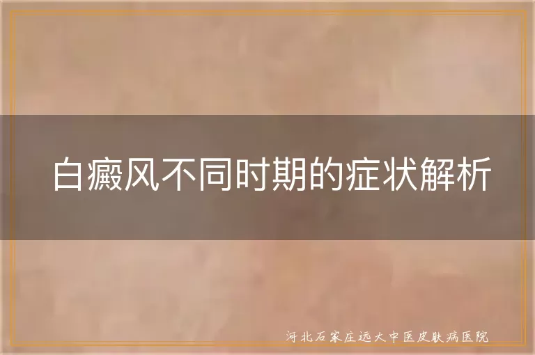 白癜风,早期,进展期,稳定期,晚期,白斑,症状,治疗