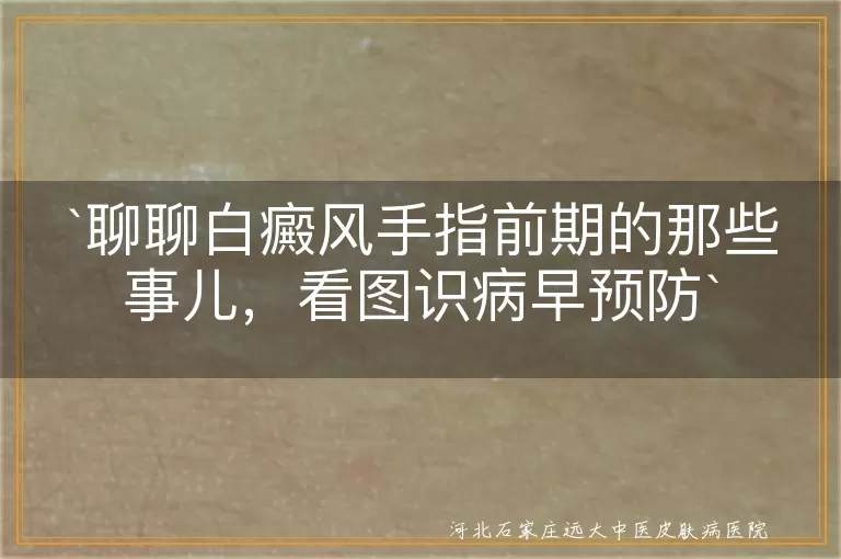 白癜风,手指前期,颜色变化,保护皮肤,预防