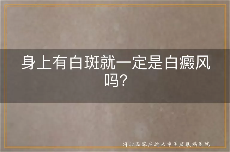 白斑,白癜风,白色糠疹,花斑癣,贫血痣,症状,判断,治疗,预防
