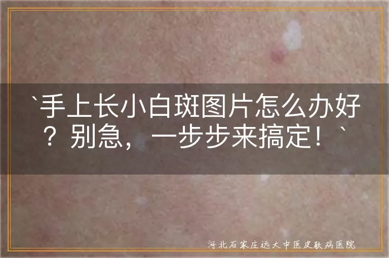 手上小白斑,观察,拍照,生活习惯,饮食调理,维生素,不乱用药,好心情,定期复查