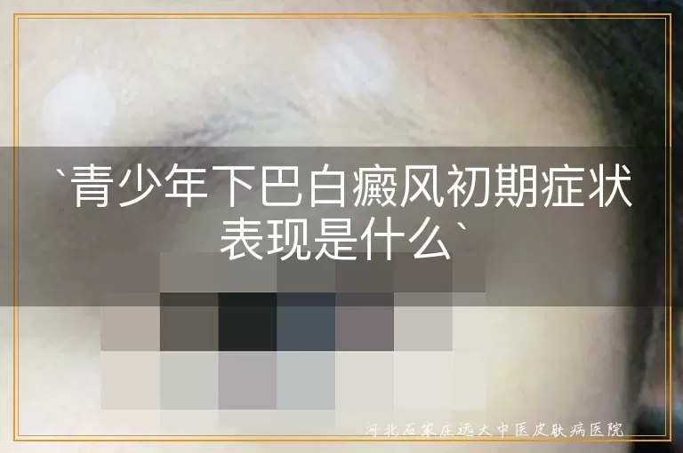 青少年,下巴白癜风,初期症状,白斑,皮肤瘙痒,心理压力