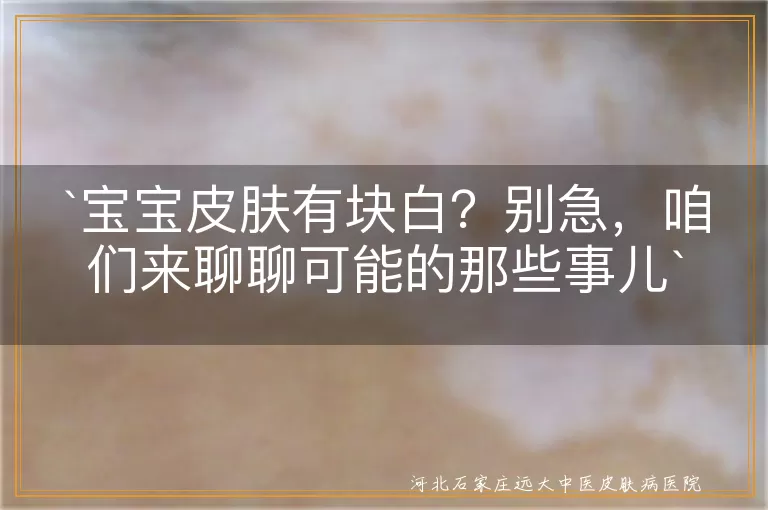 宝宝皮肤,白斑,无色素痣,贫血痣,白色糠疹,白癜风,防晒,保湿,营养均衡