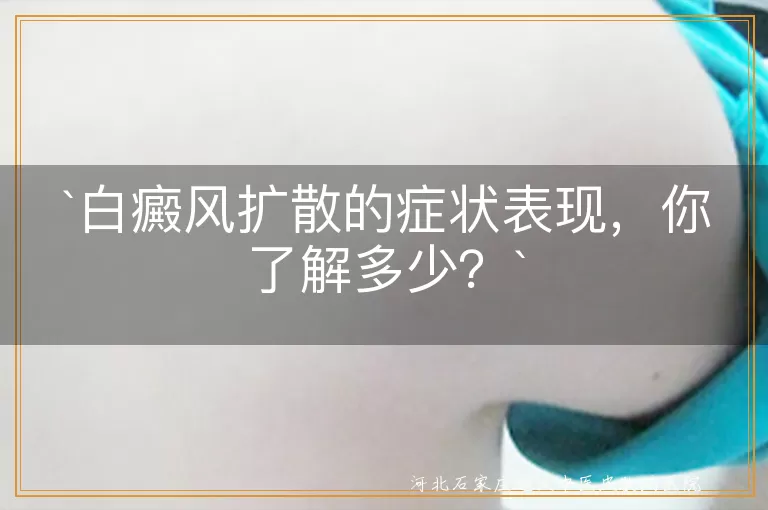 白癜风,扩散,白斑面积增大,颜色变化,边缘模糊,数量增多,新白斑,其他症状