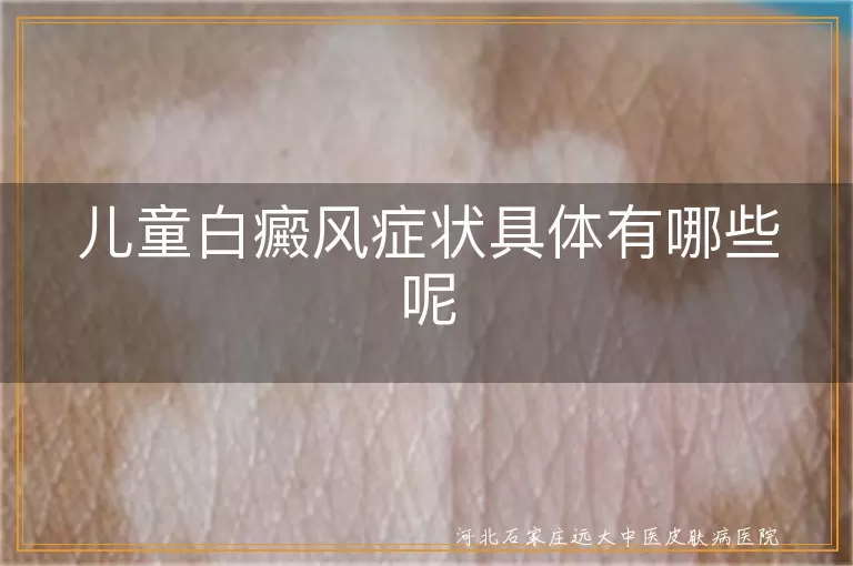 儿童白癜风症状具体有哪些呢