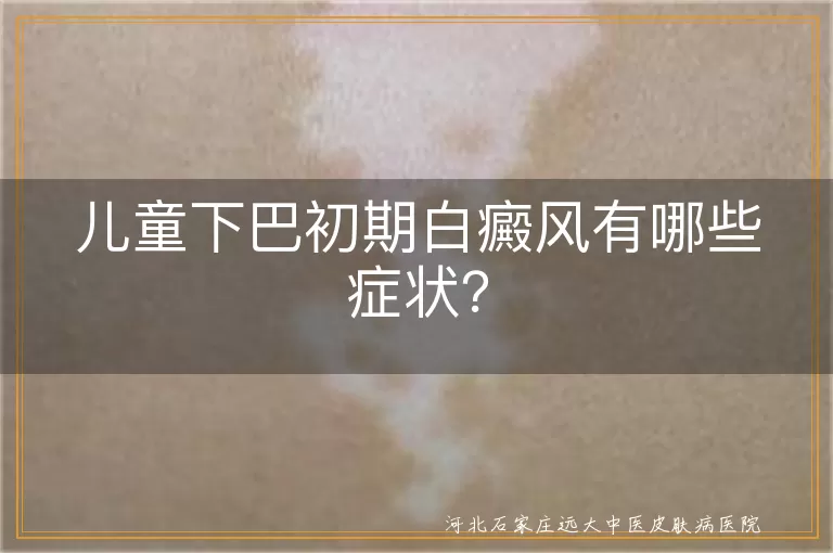 儿童白癜风,初期症状,治疗,预防,护理
