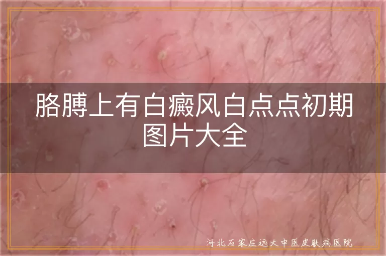 胳膊,白癜风,白点点,初期,图片,症状,辨别,治疗