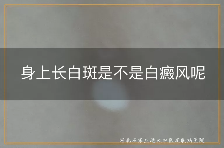 白斑,白癜风,皮肤病,症状,治疗,预防
