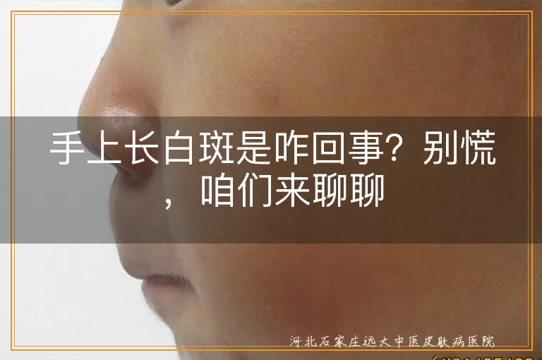 手上白斑,白癜风,无色素痣,炎症后色素减退,缺乏微量元素,日晒,就医,治疗,预防