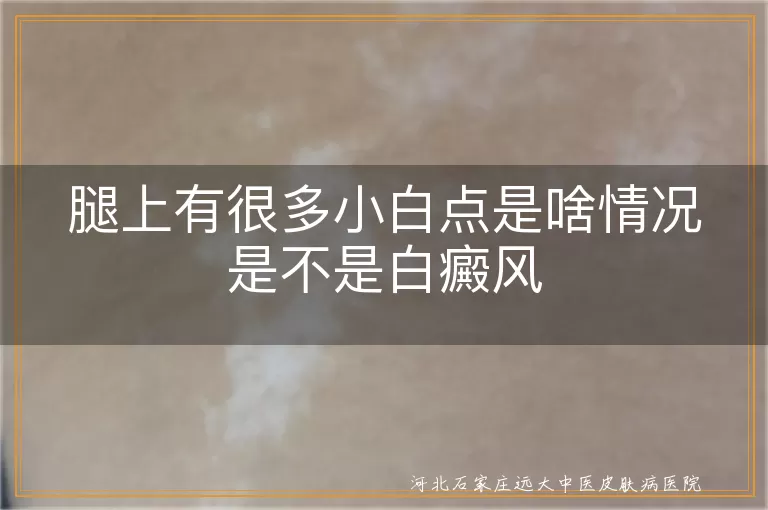 腿上小白点是否是白癜风,白癜风白斑特点,腿上白斑可能原因,白癜风治疗与诊断