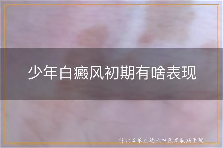 少年白癜风初期症状,白斑慢慢变大,白斑边缘清楚,情绪影响白斑