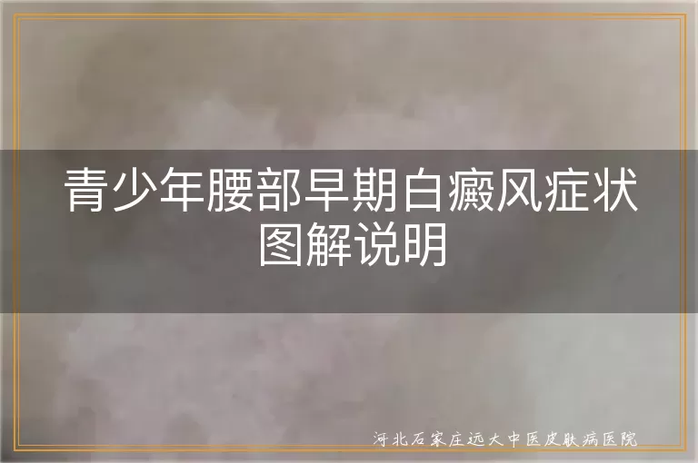 青少年腰部白癜风初期症状,白斑颜色与边缘变化,白癜风白斑表面光滑,白癜风伴随症状表现