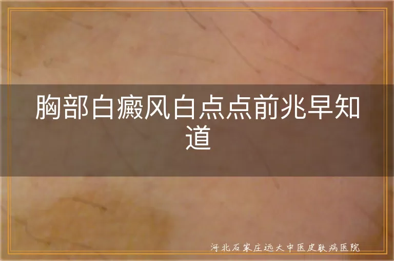 胸部白癜风前兆,白癜风早期症状,白斑出现前兆,皮肤感觉异常与白癜风