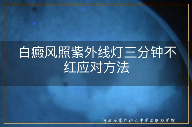 白癜风紫外线治疗无反应,白癜风照射时间调整,白癜风综合治疗策略,白癜风日常护理建议