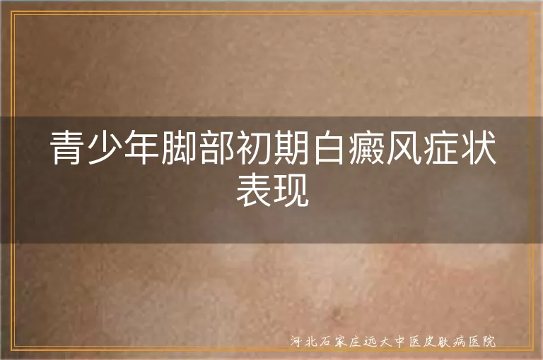 青少年脚部白癜风症状,青少年脚部白斑表现,初期白癜风症状识别,白癜风初期症状