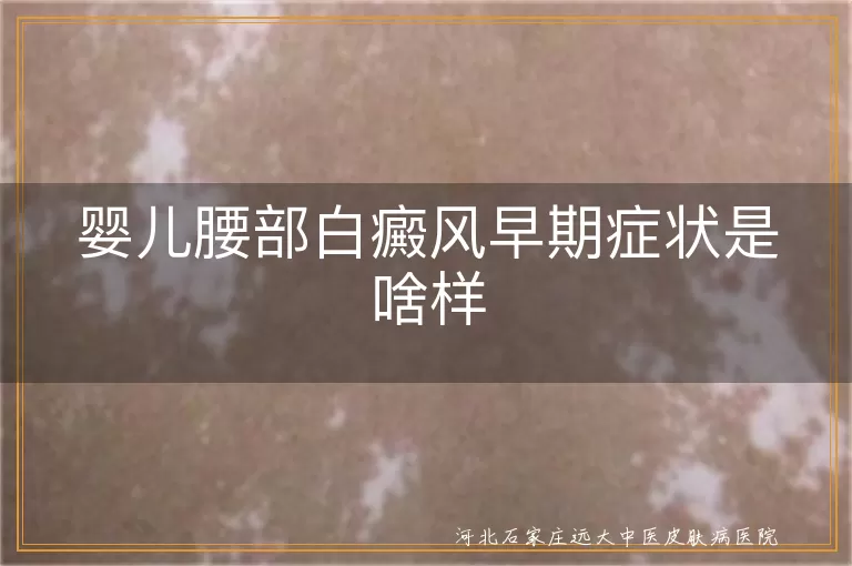婴儿腰部白癜风初期表现,宝宝白斑症状图解,白癜风早期识别方法,婴幼儿白斑病初期图片