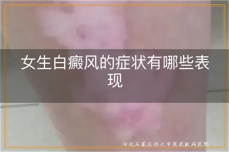 女生白癜风初期症状,白斑扩散表现,白癜风颜色变化,白斑感觉异常