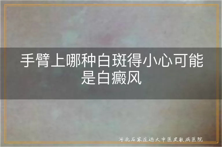 手臂白斑症状,白癜风识别,白斑逐渐扩大,皮肤光滑无鳞屑