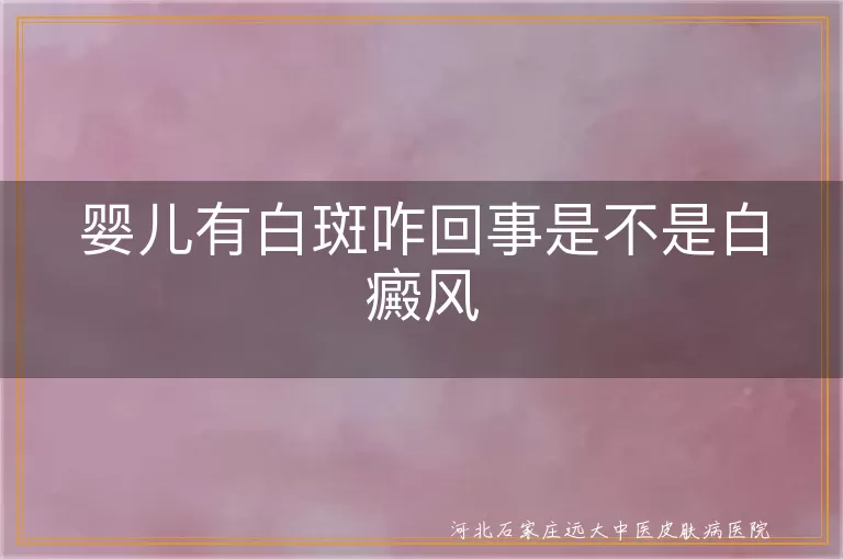 婴儿白斑原因,白癜风特征,婴儿白癜风治疗,白斑日常护理