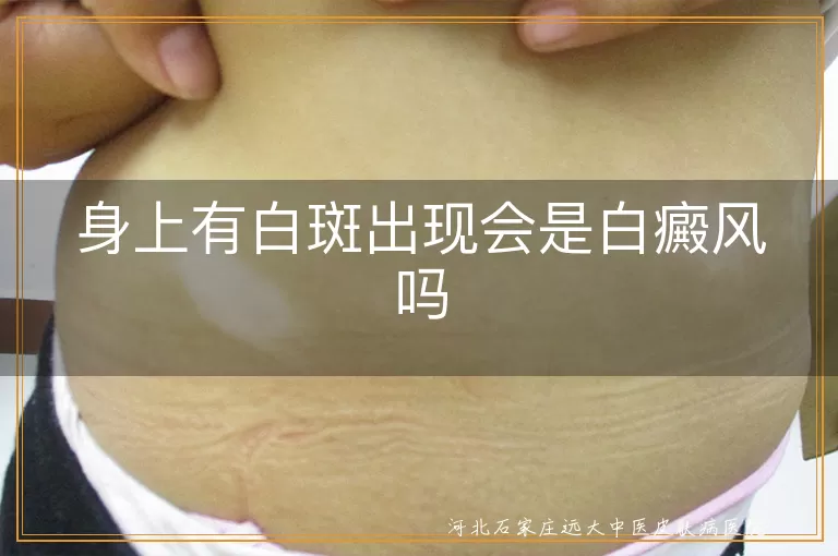 白斑原因多样,白癜风判断依据,白斑治疗方法,白癜风生活注意事项