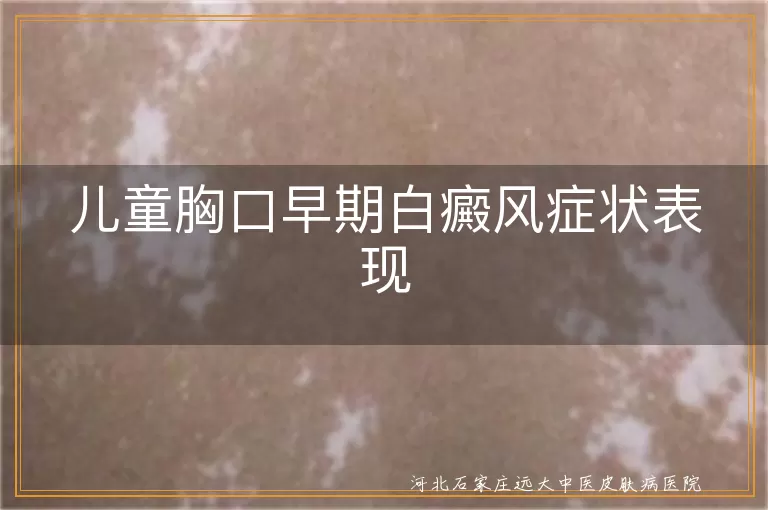 儿童胸口白癜风症状,早期白癜风白斑表现,胸口白斑识别,白癜风早期预防