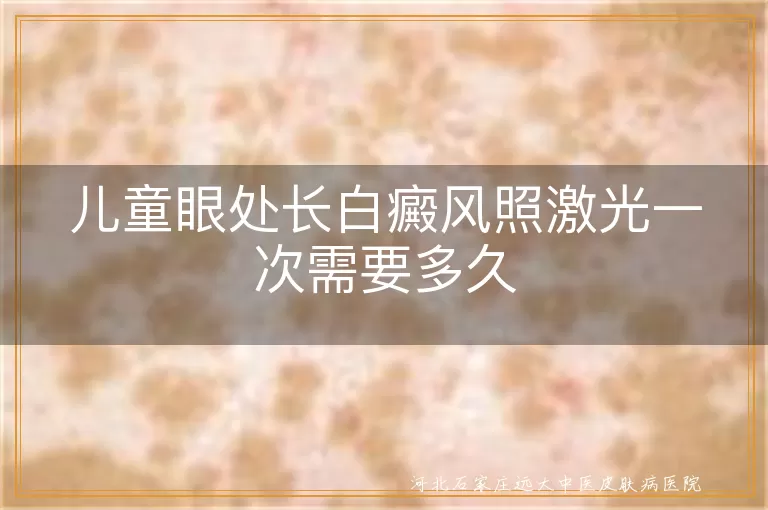 儿童眼处长白癜风照激光时间, 白癜风激光治疗时长, 白癜风眼部治疗时间, 白斑激光治疗一次多久