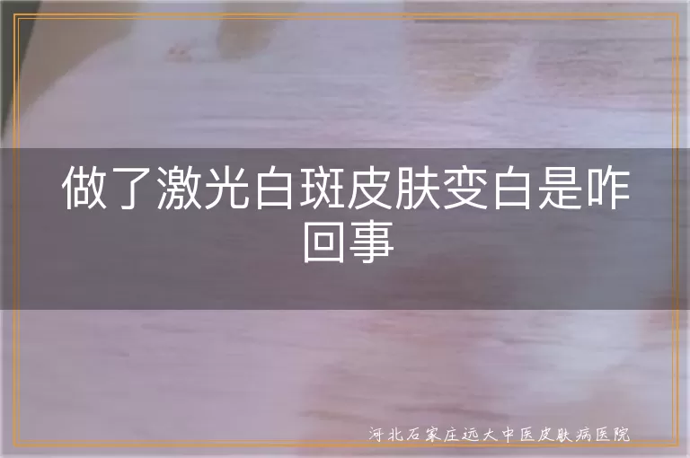 激光治疗白癜风效果,白斑皮肤激光后变白原因,白癜风激光治疗注意事项,白斑激光治疗效果如何
