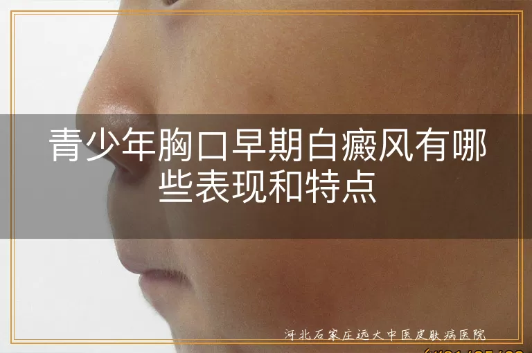 青少年胸口白癜风症状,白癜风早期表现特点,胸口白斑治疗反应,青少年白斑心理影响