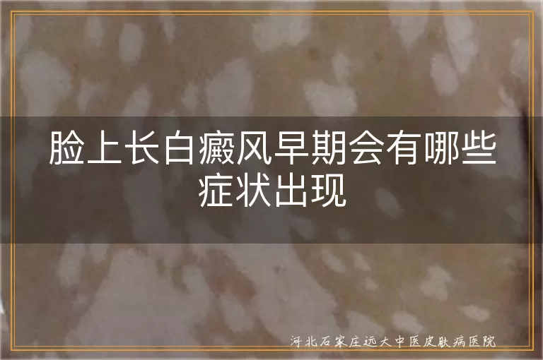 脸上白癜风早期症状,白斑初现表现,白癜风边缘变化,白癜风伴随症状