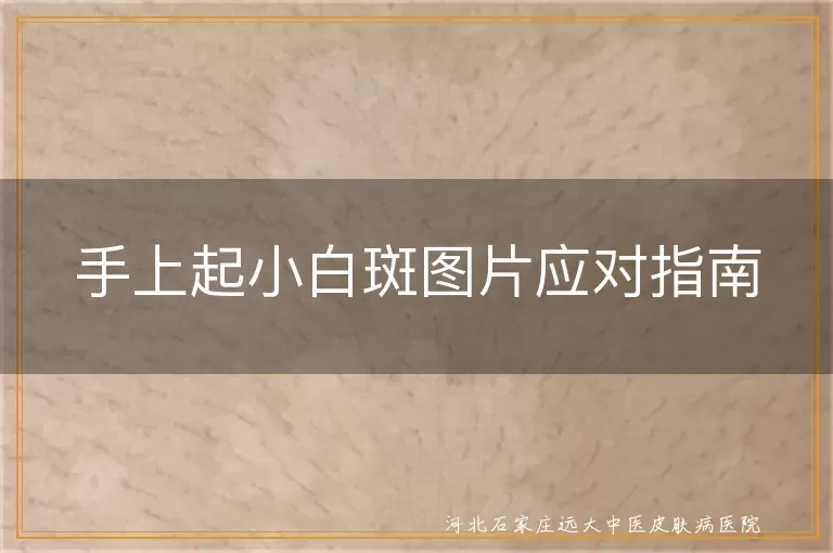 手上起白斑怎么办,白癜风治疗方法,白斑专业诊断,保持乐观心态