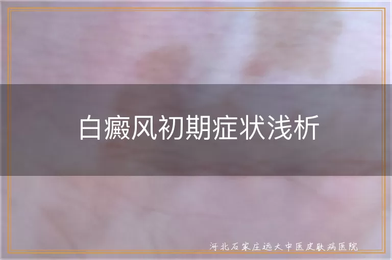 白癜风初期表现,白斑初期症状,白癜风早期迹象,白斑初期特征