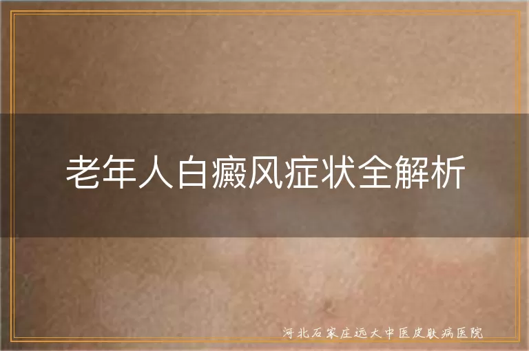 老年人白癜风初期症状,白癜风白斑扩散表现,白癜风对毛发影响,老年人白癜风心理压力