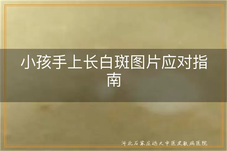 小孩手上白癜风怎么办,儿童白斑治疗方法,白癜风生活护理,白斑心理疏导