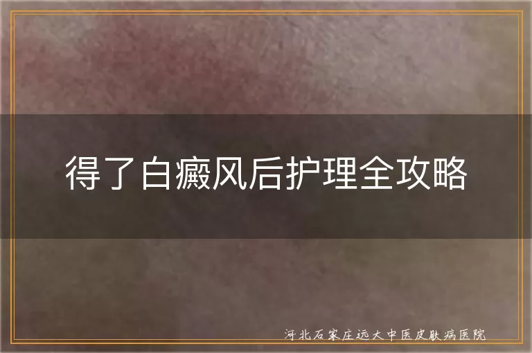 白癜风饮食护理,白癜风皮肤保护,白癜风作息调整,白癜风运动建议